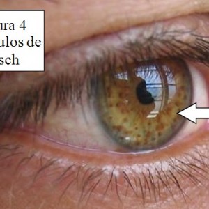 vean la parte coloreada del ojo.