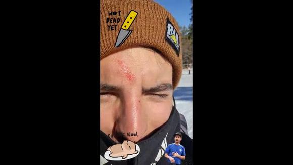 Vadhir Derbez se cayó al esquiar